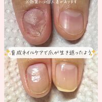 画像1462