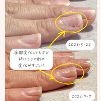 画像1515