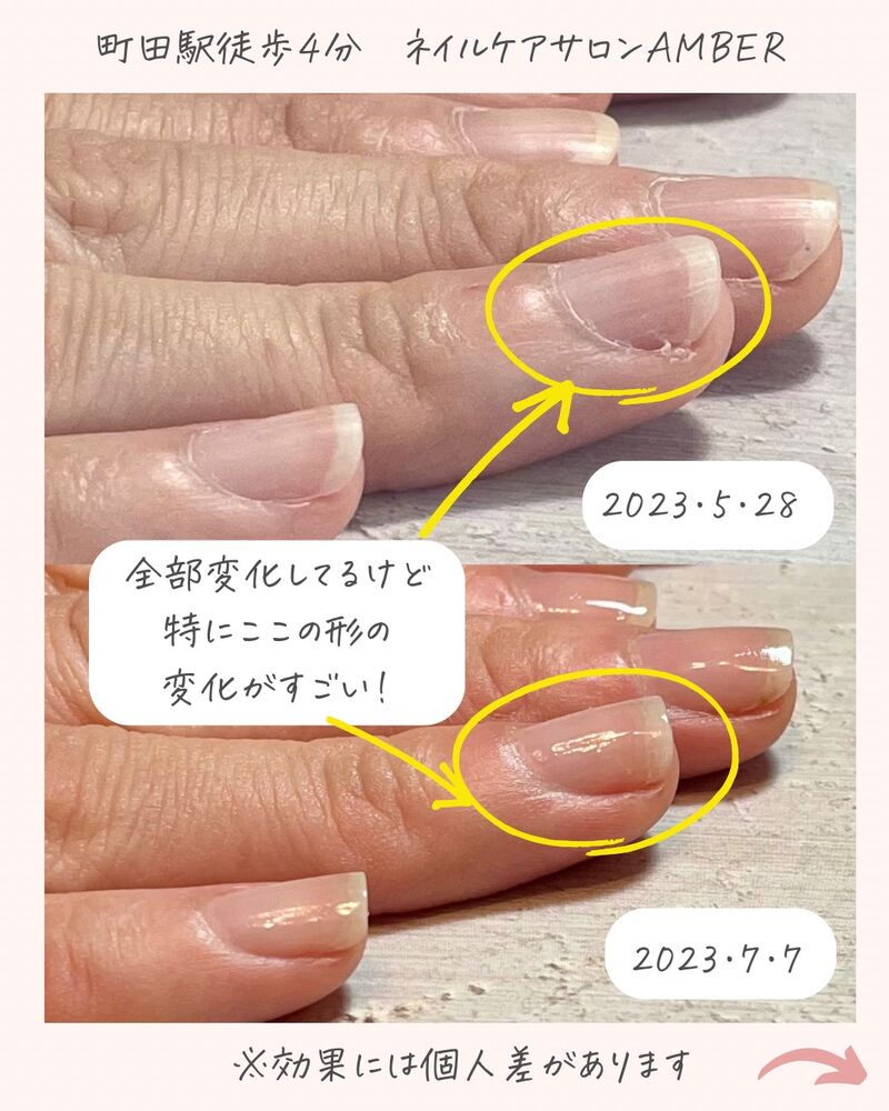 画像1515
